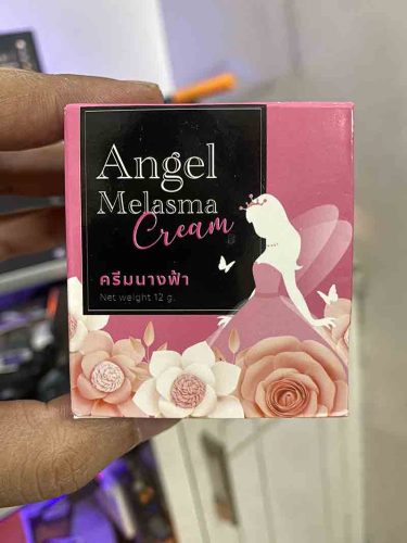 Angel Melasma Cream photo review